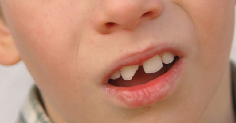 Tooth Trauma: Navigating Dental Emergencies with Confidence